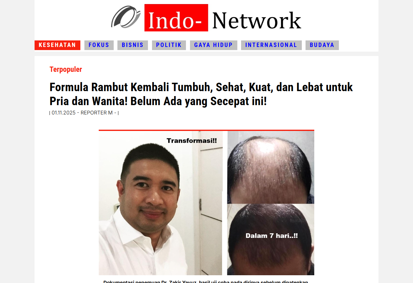 Gambar produk Follicare