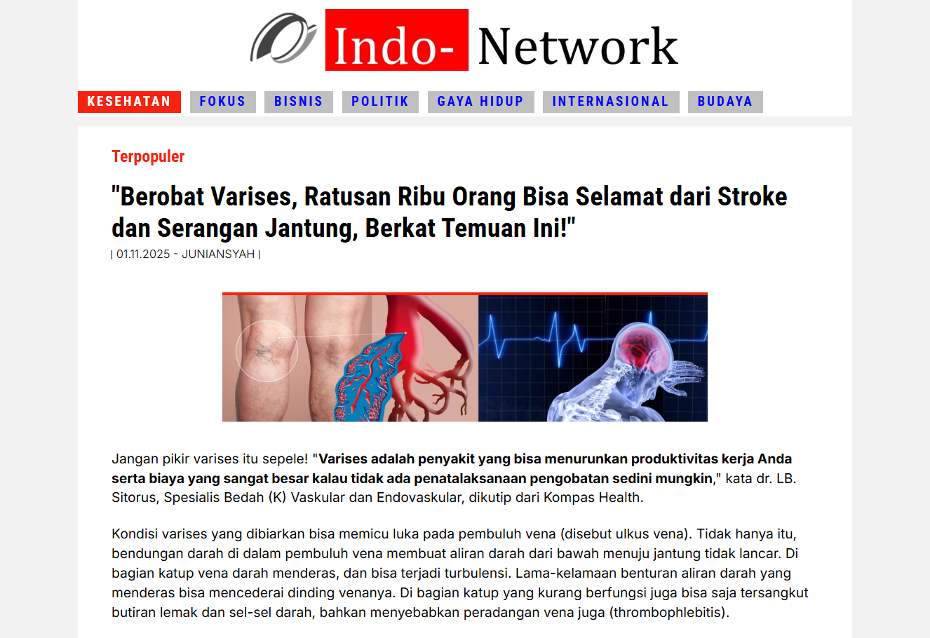 Gambar produk Varicozy